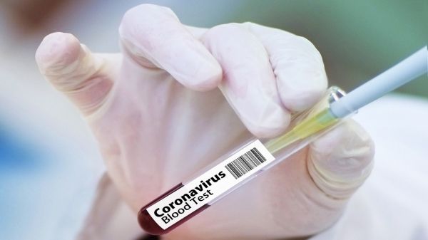 В Киеве за сутки выявили 1212 новых случаев инфицирования коронавирусом