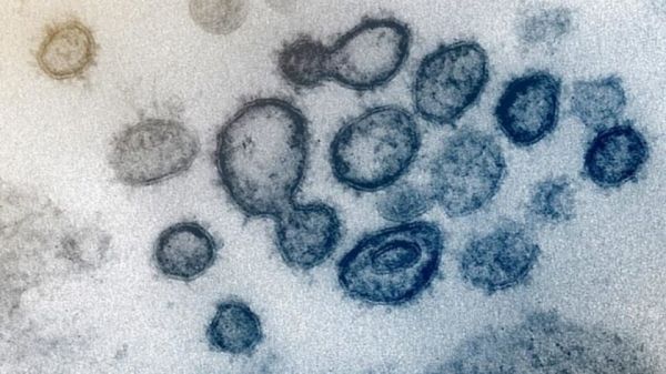 Во Франции обнаружили новый штамм коронавируса: умерли все инфицированные