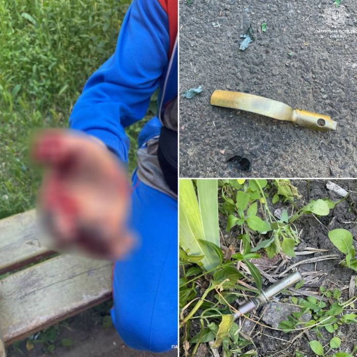 В Киеве у мужчины в руках взорвался найденный запал  к гранате