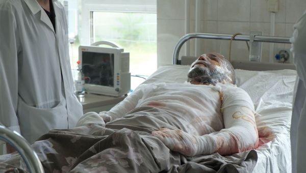 Опіки і вибухові травми. Лікарі розповіли про стан пацієнтів Вінницької обласної лікарні                    
