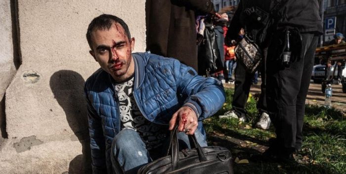 обстріл києва 10 жовтня, постраждалі, медики, госпіталізація, поранені