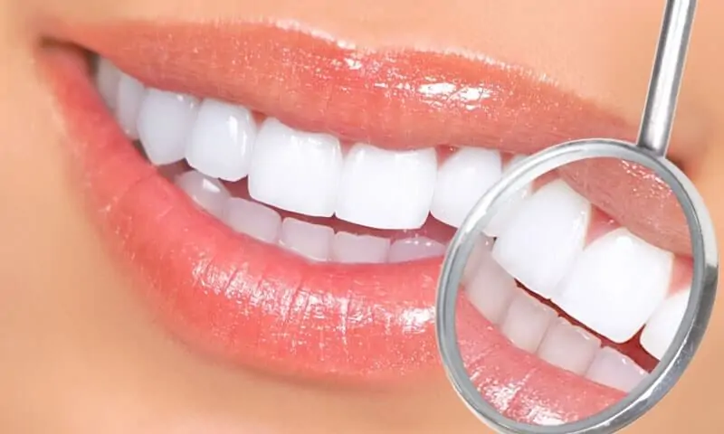 Имплантация зубов в клинике ID Dent 