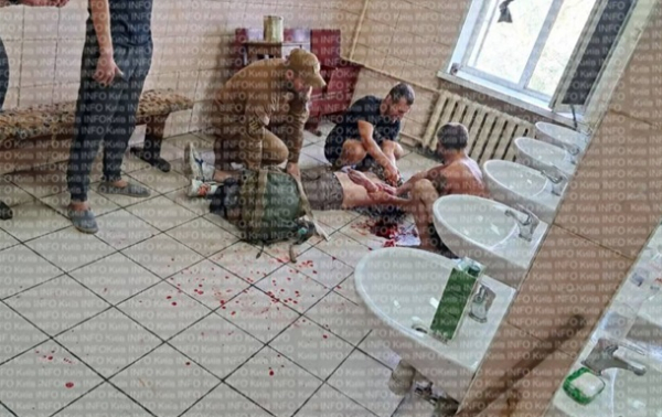 У Києві мобілізований порізав собі руки та шию на збірному пункті У Києві мобілізований порізав собі руки та шию на збірному пункті