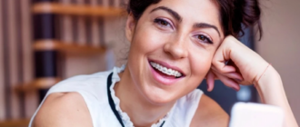 Брекет-системи