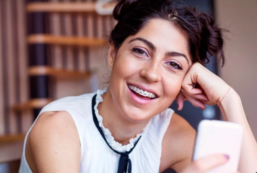 Брекет-системи